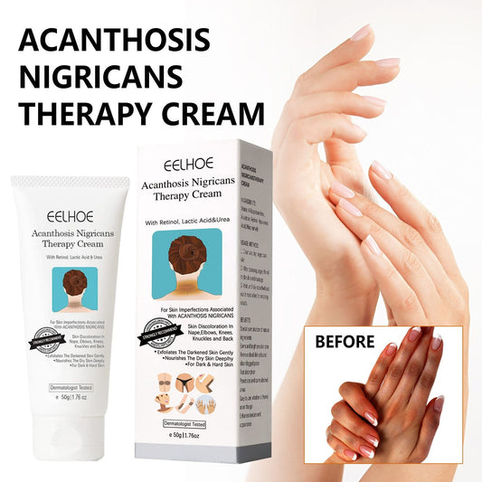 EELHOE Black Acanthoderm Cream Underarm Arm Knee Joint Black Moisturizing Care Cream