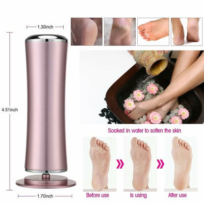 SRGARH Electric Callus Remover Foot File Adjustable Speed 60pcs Discs Pink